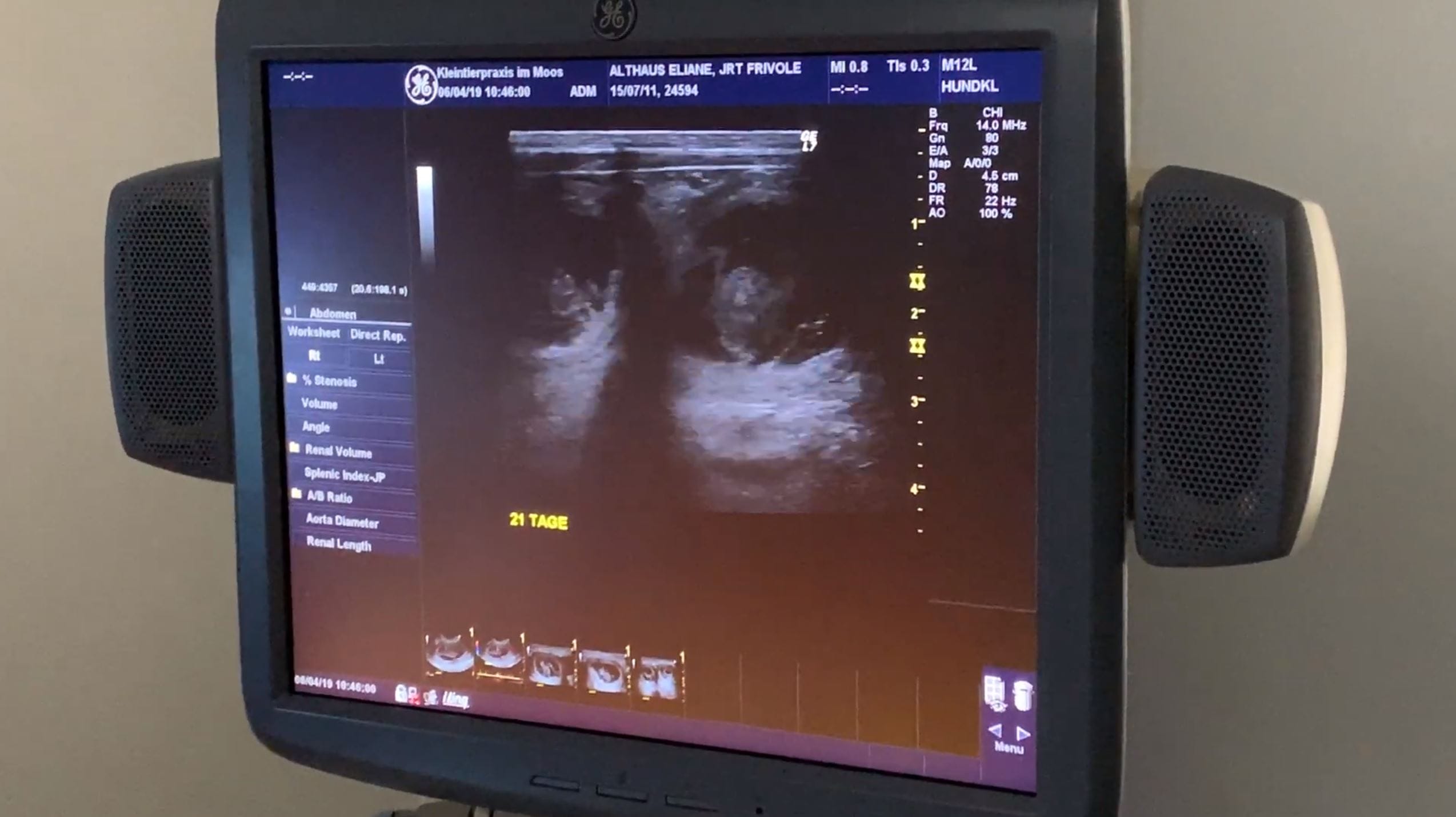 4 Ultraschall